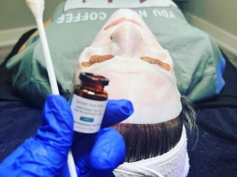 Chemical peel treatment gets rid of skin texture