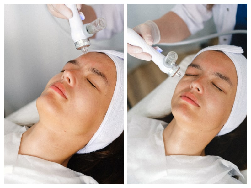 HydraFacial uses medical-grade equipment to not only purify and hydrate the skin but also dissolve dead skin and loosen pores. 