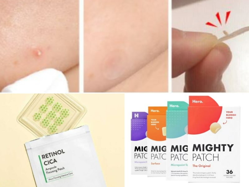 Acne patches will do the heavy lifting for you when it comes to achieving crystal clear skin. 